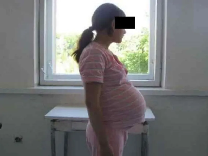 Zeci de mame de 14 ani lăsate în voia sorţii. Foto Monitorul de Botoșani