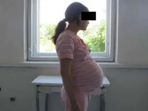 Zeci de mame de 14 ani lăsate în voia sorţii. Foto Monitorul de Botoșani