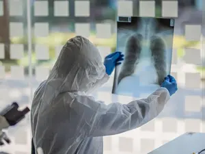 Radiografie pulmonară a unui bolnav de COVID/FOTO: Getty