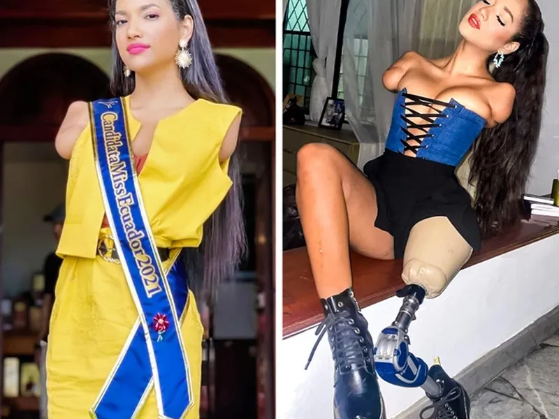 A transformat tragedia în succes. ”Sunt triplu amputată și un model sexy, nimic nu mă oprește!” - Foto: Instagram(imagine cu rol ilustrativ)