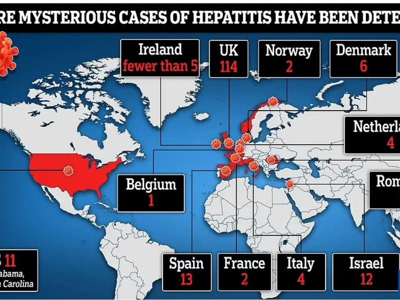 Hepatita misterioasă, ce a dus la un deces și 17 transplanturi de ficat, a ajuns și în România/foto: dailt mail