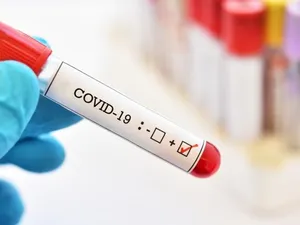 Încă 1.242 de români infectați cu coronavirus