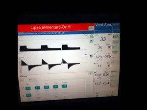 Monitor care prezintă lipsa oxigenului/FOTO: turnulsfatului.ro