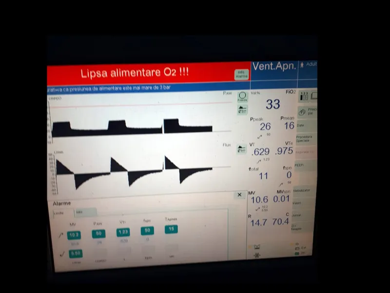 Monitor care prezintă lipsa oxigenului/FOTO: turnulsfatului.ro