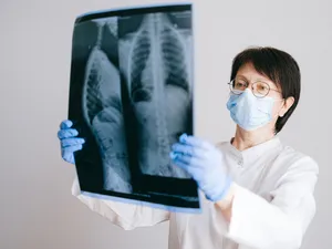 Medicii au văzut ceva suspect la radiografie (foto cu caracter ilustrativ) Foto: pexels.com