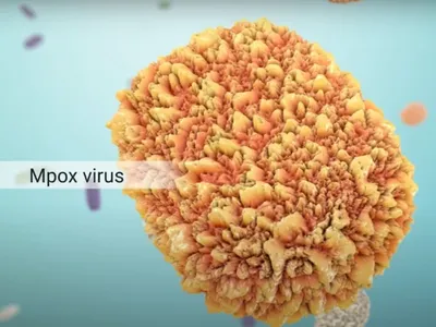 E grav: OMS a declarat epidemia de mpox o urgenţă de sănătate publică de interes internațional - Foto: captura Youtube(imagine cu rol ilustrativ)