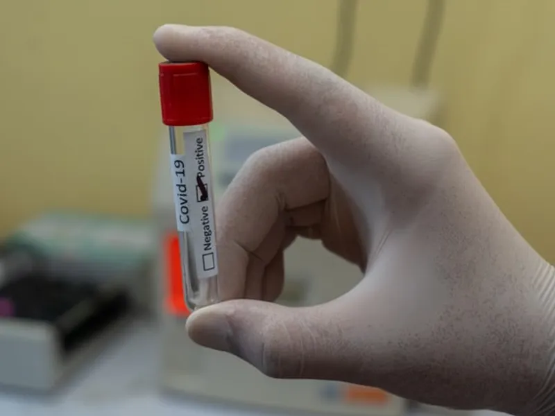 Franța cere test anti-COVID-19 pentru călătorii nevaccinați care vin din Spania și Portugalia/FOTO: Unsplash