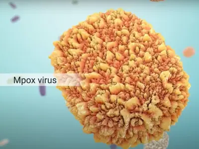 E grav: OMS a declarat epidemia de mpox o urgenţă de sănătate publică de interes internațional - Foto: captura Youtube(imagine cu rol ilustrativ)