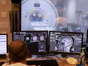 Premieră mondială: Cancerul cerebral, depistat cu ajutorul unui nou test de sânge - Foto: Profimedia Images - Rol ilustrativ